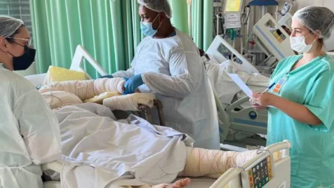 Governo de Minas Gerais amplia assistência a pacientes queimados 9 Governo de Minas Gerais amplia assistência a pacientes queimados