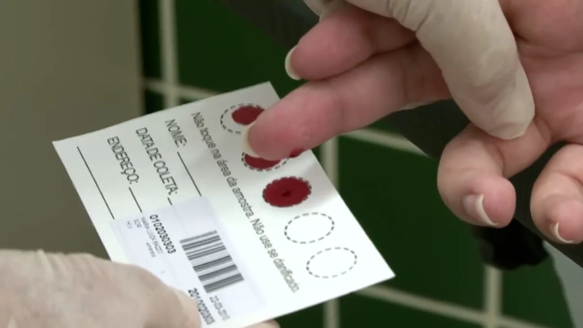 Dia Mundial da Luta contra HIV/Aids é marcado por ações em Valadares 1 Diante disso, a Prefeitura de Valadares, através do Centro de Referência em Atenção Especial à Saúde Dr