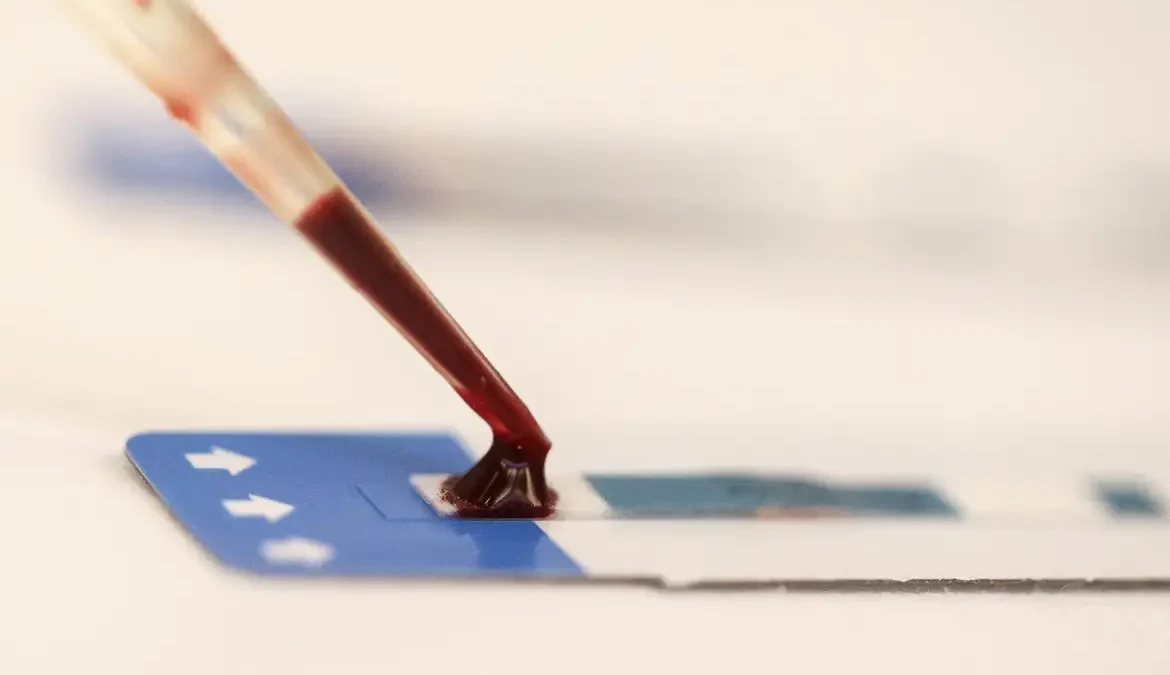 Unesco: maioria de jovens com HIV aprova acolhida em serviços de saúde 1 Mais de 50% dos jovens que vivem com HIV no Brasil aprovam o acolhimento recebido em serviços de saúde