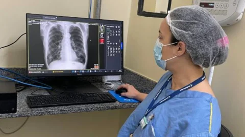 Complexo de Especialidades da Fhemig vai ampliar atendimentos com raios-x digital 1 Complexo de Especialidades da Fhemig vai ampliar atendimentos com raios-x digital