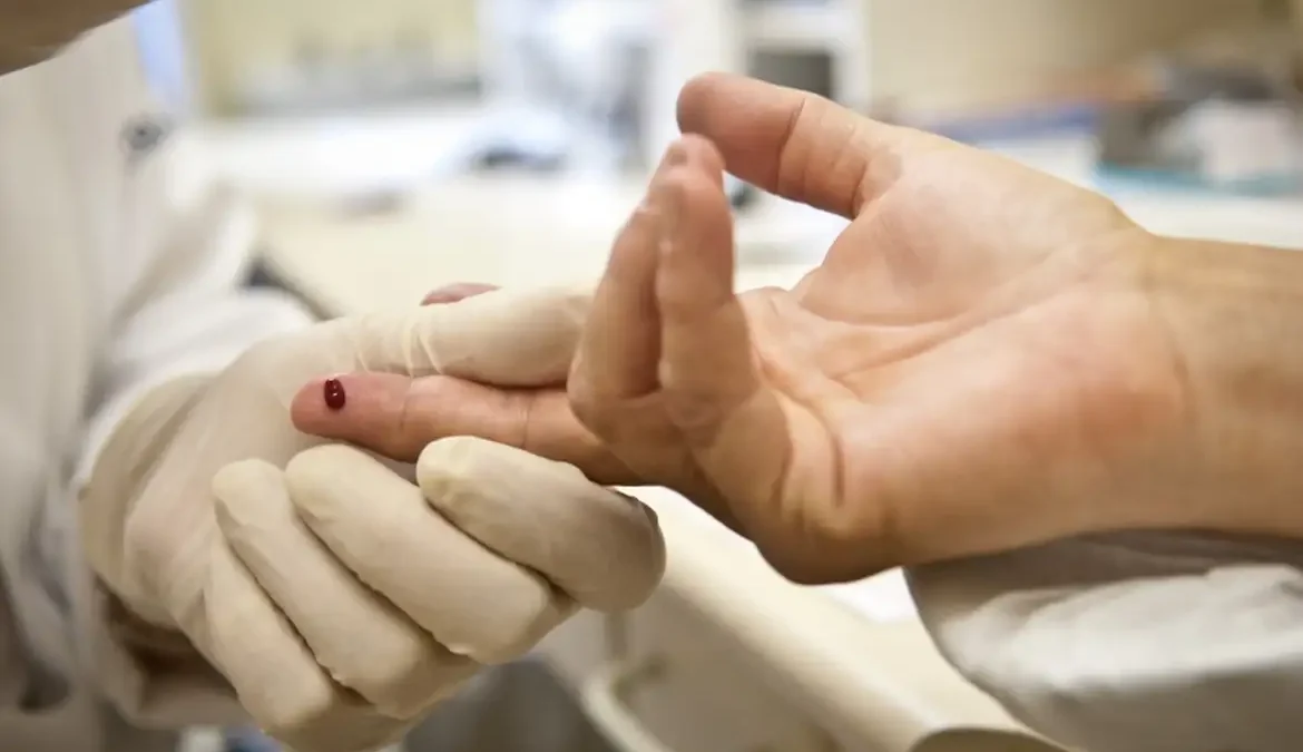 Dados do Ministério da Saúde indicam que o país vem registrando queda nos casos de HIV/aids, mas não entre homens de 15 a 29 anos