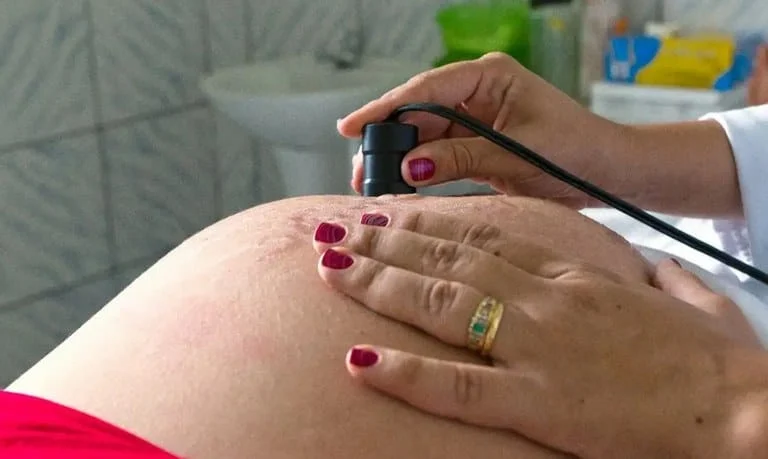 Com capacidade para mais de 583 mil atendimentos por ano, a ação beneficia 26,7 milhões de mulheres em idade fértil
