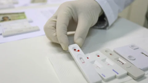 SUS incorpora teste para detecção de HPV em mulheres