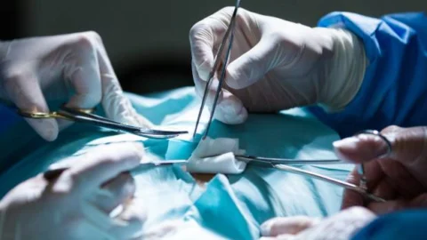 Equipe médica do Ipsemg realiza 1ª cirurgia de Tavi pela carótida