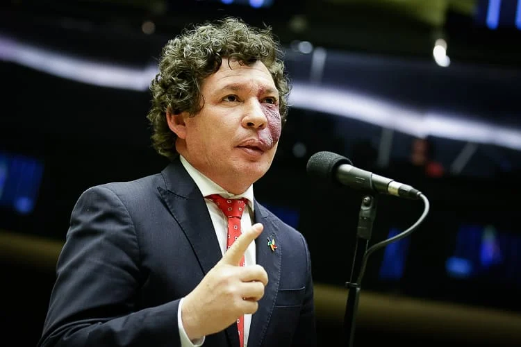 A UNIVALE fará uma aula magna sobre o tema na segunda-feira (18), às 19h, no campus II, com participação do deputado federal Reginaldo