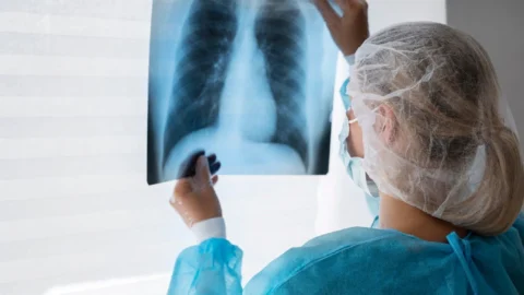 No Dia Mundial de Combate à Tuberculose, desafio ainda é a adesão ao tratamento 2 No Dia Mundial de Combate à Tuberculose, desafio ainda é a adesão ao tratamento