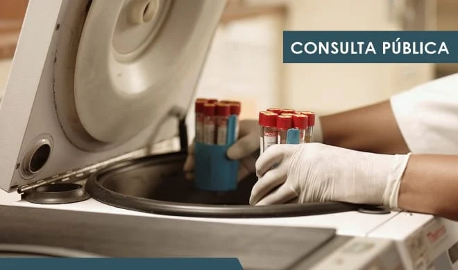O Ipsemg está disponibilizando, até o dia 19/4, uma Consulta Pública sobre contratação de empresa especializada para prestação de serviços
